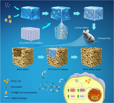 A personalized biomimetic dual-drug delivery system via controlled release of PTH1-34 and simvastatin for in situ osteoporotic bone regeneration